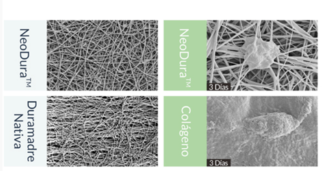 Microestructura tridimensional de NeoDura que imita la duramadre humana y promueve la rápida regeneración dural.